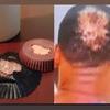 LeBron Hairline